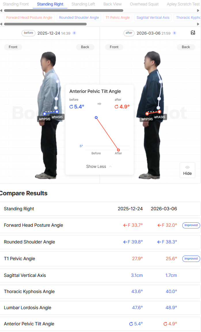 When the Pelvic Anterior–Pelvicr Tilt Measurement Has Worsened